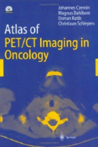 Czernin J. - Atlas of PET/CT Imaging in Oncology